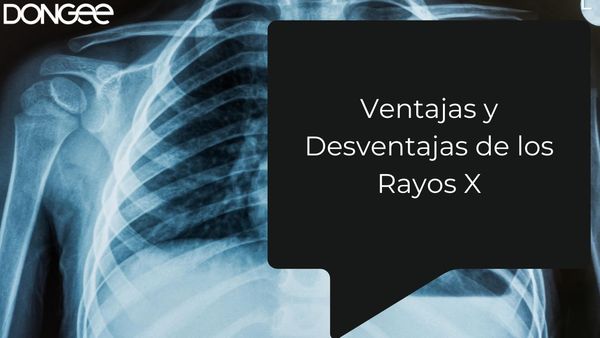 Ventajas y Desventajas de los Rayos X